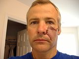 th_8-23-07surgery001.jpg