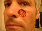 th_Robs8-18-062ndSurgery002.jpg